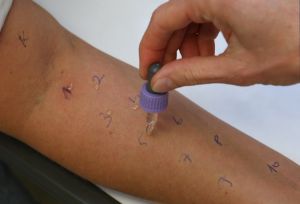 alergia-r614.jpg